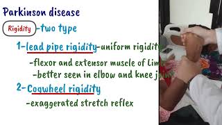 Parkinsons Disease  Clinical Features [upl. by Caughey189]