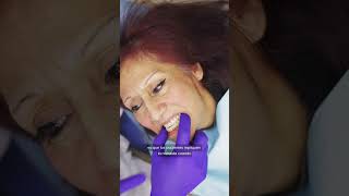 🦷 Atrofia Maxilar Superada con Implante Dental  ¡Historia Inspiradora Parte 2 shorts [upl. by Nahtnamas714]