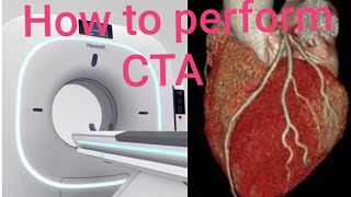 HOW TO PERFORM Cardiac Angiography [upl. by Ttoile]