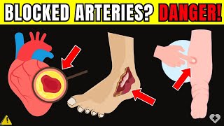 🛑 Heart Alert 7 Signs of Blocked Arteries in Legs and Feet That Could Put Your Life at Risk [upl. by Suoiradal]