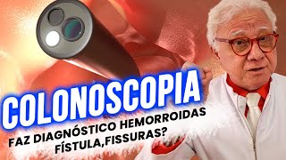 Colonoscopia Faz diagnóstico Hemorroidas fissuras fístulas [upl. by Anicnarf]