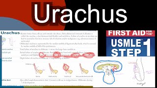 Urachus Patent Urachus Urachal cyst Vesicourachal diverticulum in HindiUrdu by first aid [upl. by Elolcin]