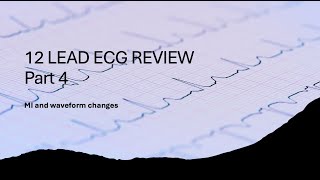 12 Lead Review Part 4 MI and Waveform Changes [upl. by Teleya169]