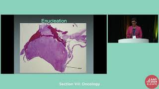 RET09Section VII Oncology [upl. by Seow]