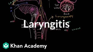 Laryngitis diagnosis treatment and prevention  NCLEXRN  Khan Academy [upl. by Iago438]