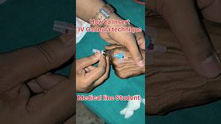 IV Cannula technique IV Cannula कैसे लगाते हैं medical nursingh bscnurcing cannula vigo bams [upl. by Anohs]