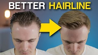 5 POWERFUL Receding Hairline Tricks To INSTANTLY Improve Your Look [upl. by Aerdnuahs]