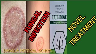 Chronic fungal infection Novel treatment of fungal infection দীর্ঘ মেয়াদি ফাংগাল ইনফেকশন। [upl. by Naimed556]