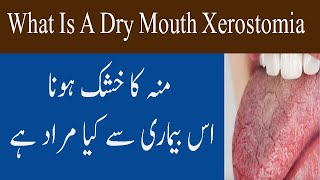 What Is Dry Mouth Xerostomia Condition In Urdu Hindi Muh Khushk Hona Ki Bimari [upl. by Euqinom]