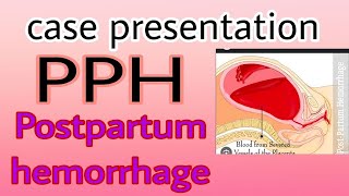 Case Presentation On Post Partum Hemorrhage PPH Bsc nursingGNM  Obg [upl. by Irtemed548]