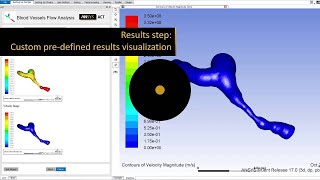 ANSYS ACT Global Update ANSYS 17 [upl. by Ahsyle973]