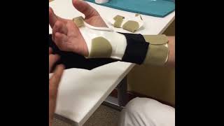 Dynamic composite finger flexion splint [upl. by Pearce]