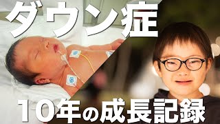 ダウン症 10年間の成長記録と息子への想い [upl. by Etam]