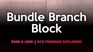 Left and Right Bundle Branch Block ECG Made Easy [upl. by Letch]