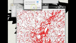 Quantifying Stained Liver Tissue Area Using ImageJ [upl. by Novit]