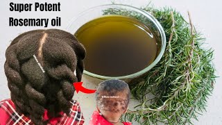 The ONLY Strongest POTENT Rosemary Oil you will ever use for x10 faster hair growth [upl. by Ynnad]