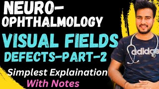 Visual Field Defect2Lesions Of Visual PathwayNEUROOPHTHALMOLOGY [upl. by Wartow]