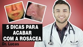 4 Dicas para Combater a Rosácea Vermelhidão no rosto [upl. by Eiramoj]