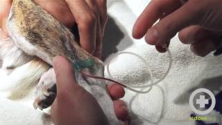 How to Do a Butterfly Catheter Blood Draw [upl. by Charbonneau]