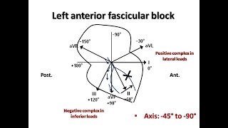 ECG course Fascicular Blocks Dr Sherif Altoukhy [upl. by Drews]