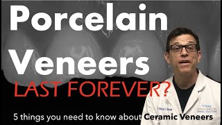 Ceramic Veneers 5 Things You Should Know About Ceramic Veneers [upl. by Annavaig]