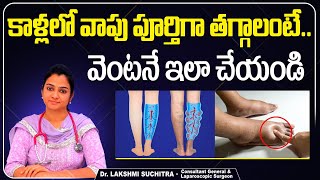 కాళ్లలో వాపు తగ్గాలంటే  Tips To Reduce Leg Swelling In Telugu  Cellulitis Treatment  Sankhya [upl. by Efrem]