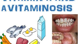 Vitamin A  Synthesis Regulation Functions Deficiency and hypervitaminosis [upl. by Atimad]