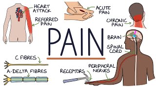 Understanding The Causes of Pain and Pain Management [upl. by Tada]