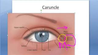 Ophthalmology 068 d Eye Caruncle What is Modified skin [upl. by Woodruff]