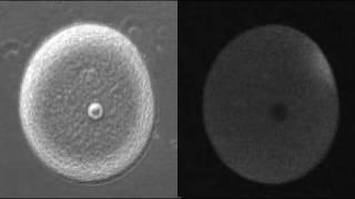 Fertilization  Calcium Wave [upl. by Gretchen277]