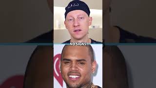 Did Chris Brown Have Plastic Surgery [upl. by Marchelle]