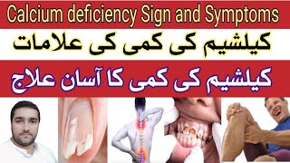 Calcium Deficiency Sign amp Symptoms and Treatment in UrduHindi  Best natural sources of Calcium [upl. by Idnahs]