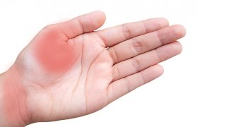 5 Home Remedies For Hand Numbness [upl. by Felder65]