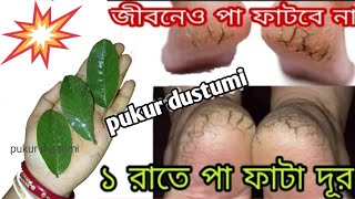 মৃত্যুর আগে পর্যন্ত পা ফাটবে নাসারা দিন কাদা জলে থাকলেও পা ফাটবে নাপাফাটা থেকে চিরতরে মুক্তিhacks [upl. by Wyatan]