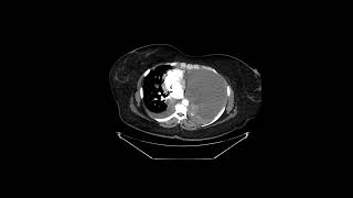 Abdominal Case Conference  12142021 [upl. by Undry]