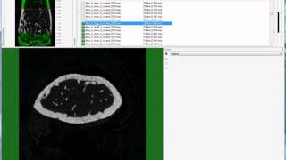 Setting the trabecular VOI for mouse femur [upl. by Haziza]