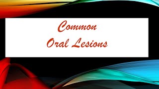 Common Oral Lesions  Definitions [upl. by Deland]