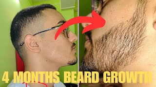 Minoxidil beard growth transformation My 4 months beard growth journey [upl. by Anegroeg]