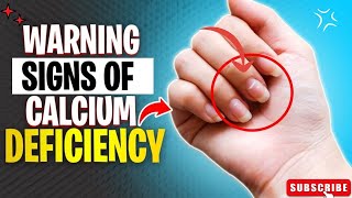 WARNING SIGNS AND SYMPTOMS YOU ARE SUFFERING FROM CALCIUM DEFICIENCYcalcium calciumdeficiency [upl. by Mishaan272]