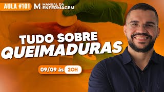 TUDO QUE VOCÊ PRECISA SABER SOBRE QUEIMADURAS  VIDEO AULA 101 [upl. by Barncard]