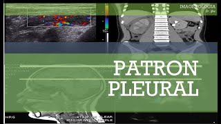 Patrón Pleural 2024 CII [upl. by Norven]