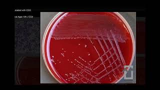 Actinotignum schaalii Actinobaculum schaalii  Microbiology [upl. by Wertz732]