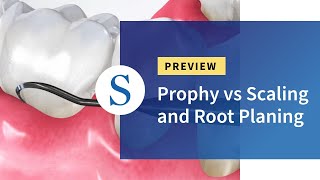 DEEP SCALING AND ROOT PLANING FIGHT GUM DISEASE EFFECTIVELY 🦷🔍💪 [upl. by Maite]