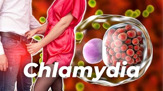 Sneaky Chlamydia  Do You Have It amp Not Know It [upl. by Nnael690]