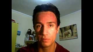 50 TCA Peel  The Results  Day 3  Trying to get rid of acne scars and melasma [upl. by Zildjian316]