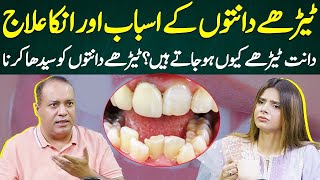 Causes and Treatment of Crooked Teeth  Ayesha Nasir [upl. by Clement]