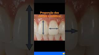 Restaurações estéticas em dentes anteriores [upl. by Rintoul]