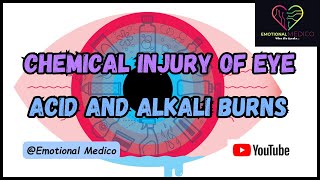 Chemical Injury of Eye  Acid and Alkali burns  Eye  emotionalmedico [upl. by Afinom800]