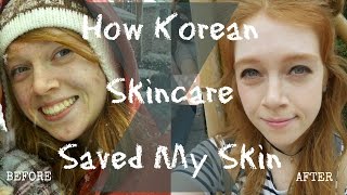 How Korean Skincare Saved My Skin  Living In Korea  Madi Miso [upl. by Jochbed]