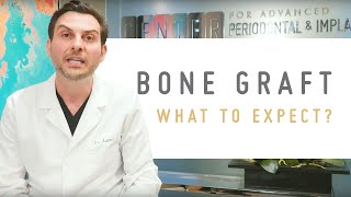 Bone Graft Procedure What to expect [upl. by Rolyab953]